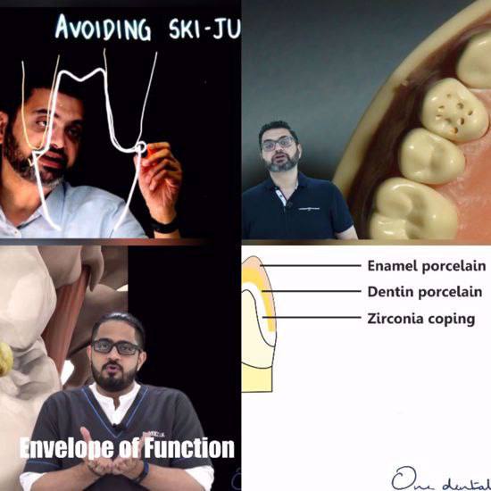 Everyday Fixed Prosthodontics