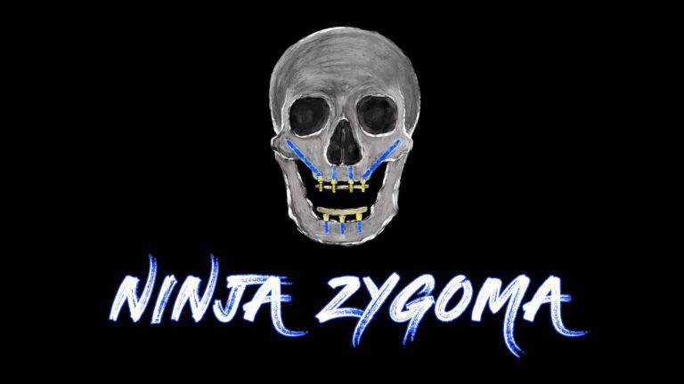 Zygomatic implant course – Implant Ninja