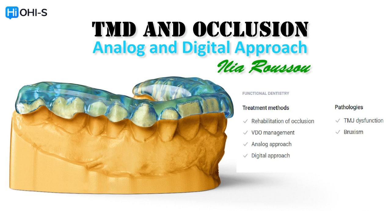 OHI-S TMD and Occlusion, Analog and Digital Approach