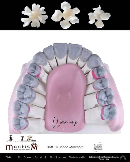 Ceramic Restorations:  Veneers, Inlays, Crowns