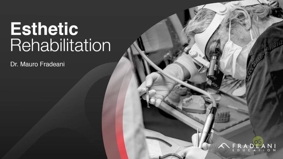 Esthetic Rehabilitation By: Mauro Fradeani