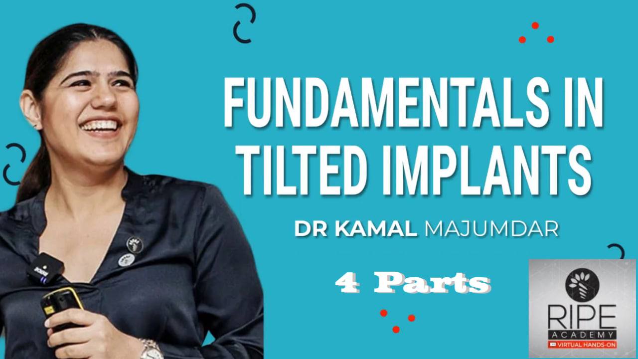 Fundamentals of tilted implants + Full arch reconstruction with tilted implants