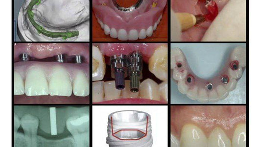 gIDE Dental A-Z in Restorative Implant Dentistry (CME VIDEOS)           By: George Perri