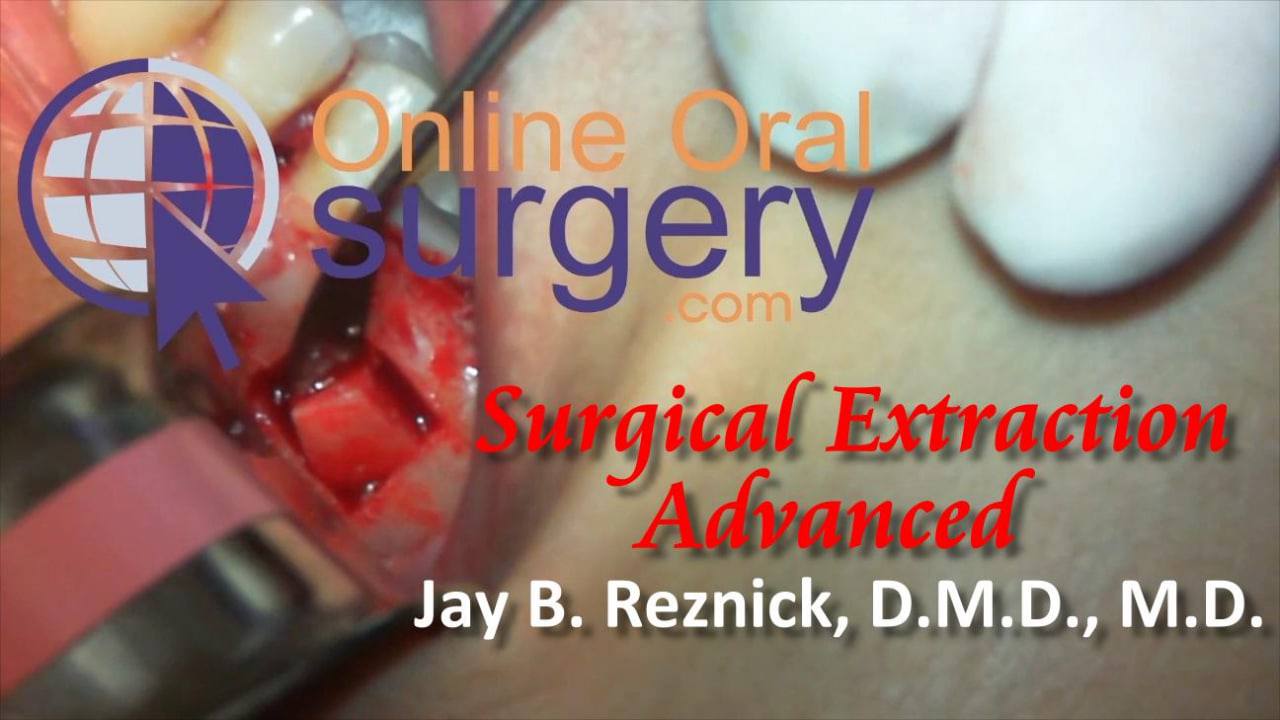 OnlineOralSurgery Surgical Extraction Advanced