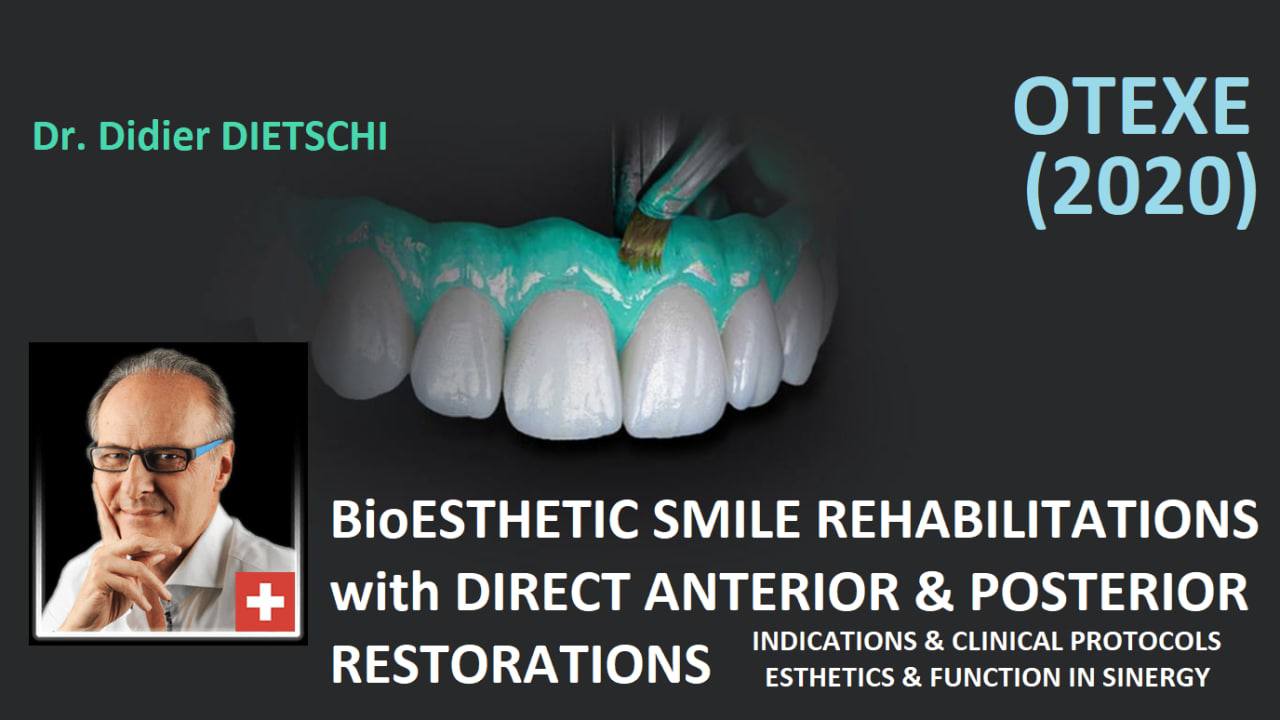 OTEXEDent BioEsthetic Smile Rehabilitations with Direct Anterior & Posterior Restorations Indication & Clinical Protocols - Estheic & Function in Sinergy